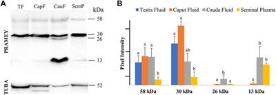 The Dynamic of PRAMEY Isoforms in Testis and Epididymis Suggests Their Involvement in Spermatozoa Maturation